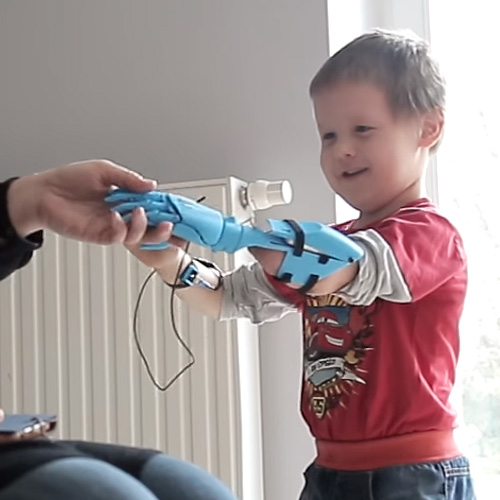 vBionic prosthetic hand